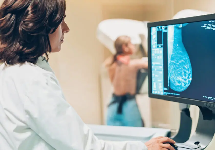¿Mamografías antes de los 30 años?